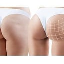 Foto de Levantamiento de Glúteos