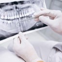 Foto de Radiografías Dentales