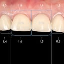 Foto de Gingivectomia