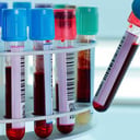 Foto de QUIMICA SANGUINEA DE 3 ELEMENTOS