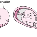 Foto de Parto eutocico