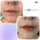 Foto de Lip Glow-Up