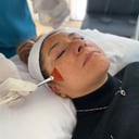 Foto de Peeling Químico