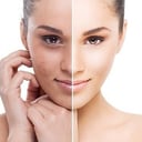 Foto de Smart Peeling