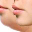 Foto de Perfilamiento Facial