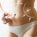 Foto de Lipo sin Cirugía Enzimática - 13 tratamientos