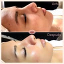 Foto de Limpieza Facial Profunda