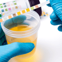 Foto de EXAMEN GENERAL DE ORINA