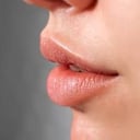 Foto de Botox Lip Flip